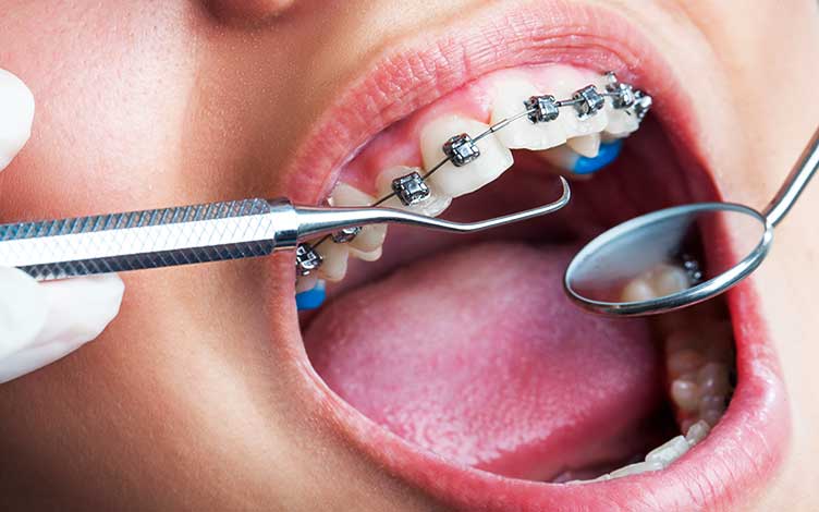 Orthodontist in Barsha- Best Dental Clininc in Al Barsha, Dubai