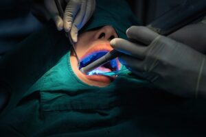 Maxillofacial Surgery Dubai
