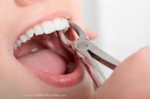 Regenerate dental enamel