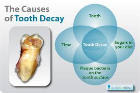 causes of tooth erosion