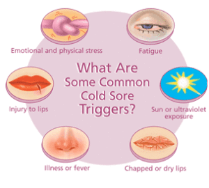 symptoms of herpes cold sore