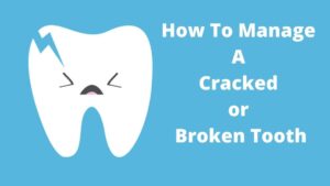 how to manage a cracked or broken tooth