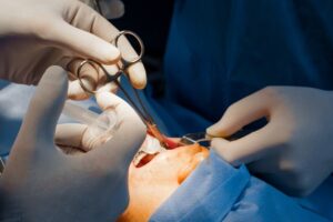 Understanding Maxillofacial Surgery