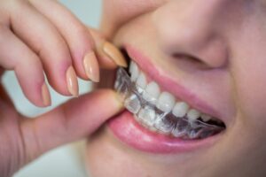 improved oral health