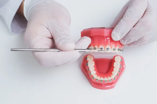 How to Choose the Right Orthodontic Treatment?